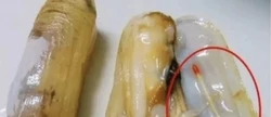 蛏子里的这个是寄生虫吗？