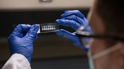 阿尔茨海默病可能导致大脑网络和免疫细胞功能障碍之间的恶性循环